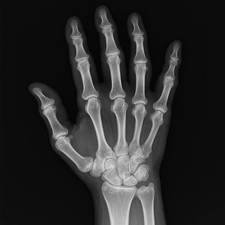 Артрит: причини та лікування